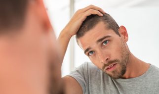 Problemy z łysieniem