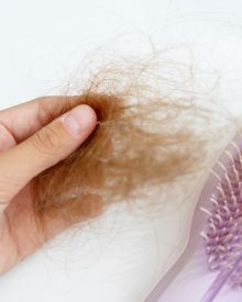 Rodzaje wypadania włosów